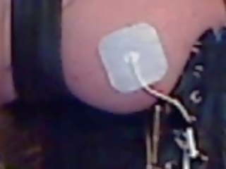 Електрически stimulation на надясно гърди